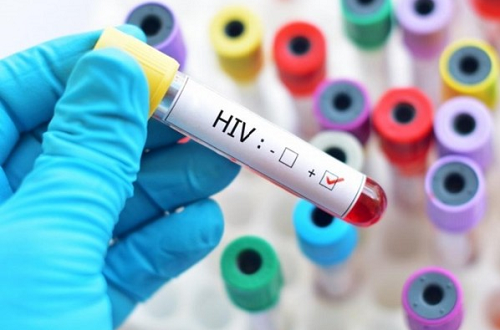 Dấu hiệu nhiễm HIV là gì? Tầm quan trọng của tầm soát sớm HIV 